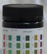 How to detect urinary protein