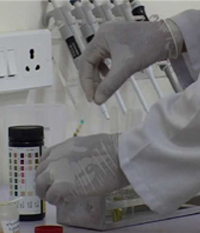 How to detect urinary protein